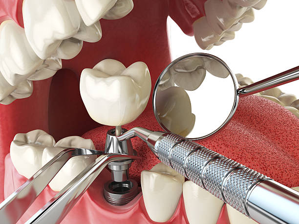 Best Emergency Gum Treatment in Welcome, NC