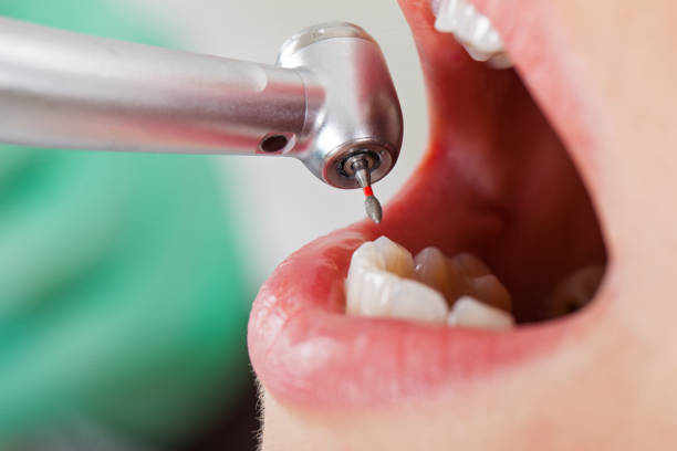 Best Urgent Care for Lost Fillings or Crowns in Welcome, NC